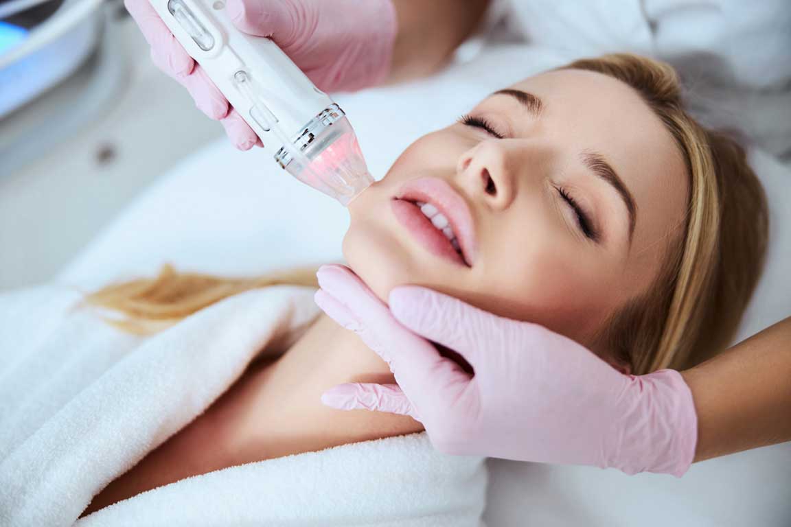 Radio Frequency (RF) Microneedling at Radiant Med Spas
